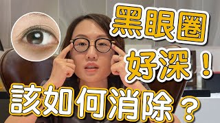 大家常常在問的黑眼圈可以怎麼治療？讓莊盈彥醫師來告訴你！ [upl. by Aissila]