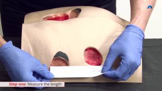 How to Measure a Wound  Measuring Wound Dimensions  Ausmed Education [upl. by Devaney]