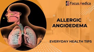 Allergic angioedemaSkin Allergy [upl. by Kirven]