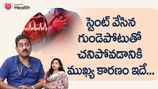 Heart Stents  స్టెంట్ వేసిన గుండెపోటుతో చనిపోవడానికి కారణం Dr A Sreenivas Kumar TeluguOneHealth [upl. by Sudoeht]