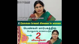 Fibroadenosis  Breast disease in women பெண்கள் மார்பகத்தில் பொதுவாக காணப்படும் 2 வியாதிகள் [upl. by Danella]