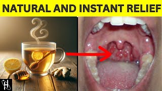 Say Goodbye To SORE THROATS With This Instant Natural Home Remedy [upl. by Atlanta694]