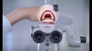 How to set up a dental microscope from ZEISS [upl. by Ylhsa74]