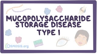 Mucopolysaccharide Storage Disease Type I Hurler HurlerScheie and Scheie syndromes [upl. by Krispin]