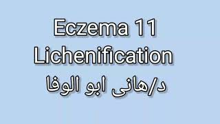 11 Lichenification by Dr Hany Abo Elwafa [upl. by Agbogla]