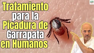 🚨 PICADURA DE GARRAPATA EN HUMANOS TRATAMIENTO MÁS EFECTIVO 🚨 [upl. by Mildred]