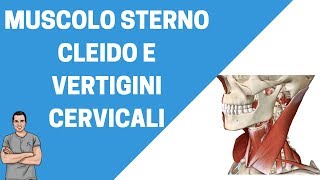 Sterno cleido mastoideo un muscolo importante nelle vertigini cervicali [upl. by Osnofedli]