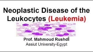 Neoplastic Disease of the Leukocytes  Leukemia Arabic Lecture [upl. by Dewhirst892]