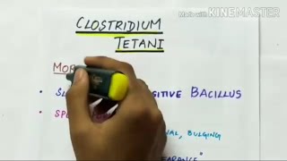 clostridium tetani  microbiology  handwritten notes [upl. by Nalani]