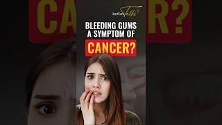 Is bleeding gums a symptom of Cancer  DentCare Talks [upl. by Tymothy71]