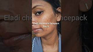 💯ഏലാദി ചൂർണ്ണം ഫേസ് പാക്ക് Day 5 facepackforacne facepackforoilyskin facepackforpimples oilyskin [upl. by Eihtak]