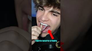 Do teeth whitening strips actually work ⁉️ [upl. by Arzed51]