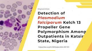 Detection of Plasmodium falciparum Kelch 13 Propeller Gene Polymorphism Among Outpatients [upl. by Naahs]