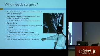 quotChiari Malformation Chiari Decompression and Neurosurgeryquot  Sean D McEvoy MD [upl. by Ennovihc]