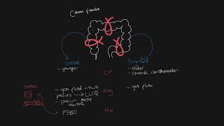 Know your caecal volvulus from sigmoid volvulus [upl. by Orva]