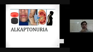 Alkaptonuria  pathophysiology  signs and symptoms  diagnosis and management  black urine disease [upl. by Cagle]