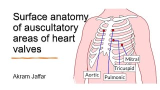 Surface anatomy of auscultatory areas of heart valves [upl. by Rubens]