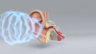 Explore the Science of Hearing Loss  MiracleEar Hearing Center [upl. by Enetsirk]