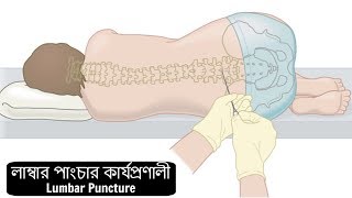 How to Perform a Lumbar Puncture [upl. by Einahpetse11]