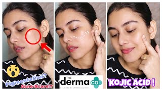 Kojic Acid For Pigmentation amp Acne Scars  The Derma Co 2 Kojic Acid Serum  Cream  Arpita Ghoshal [upl. by Ennybor572]