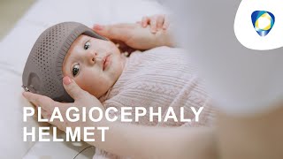 Benefits of a Plagiocephaly Helmet [upl. by Sadnac707]