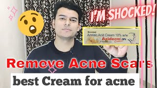 aziderm cream  aziderm cream review  aziderm cream 10  aziderm 10 gel  azelaic Acid  scarsmark [upl. by Aivin]