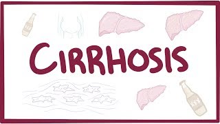 Cirrhosis  causes symptoms diagnosis treatment pathology [upl. by Brook]