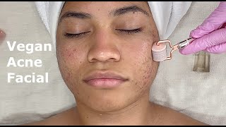 5 Step Vegan Skincare Facial SensitiveAcne to Renew Skin [upl. by Adnarom]