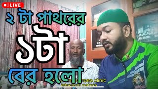 ২ টা পাথরের ১ টা বের হলো  Dr yeaman Chowdhury [upl. by Avron]