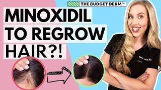 Minoxidil For Hair Loss  Everything you need to know [upl. by Lenoj]