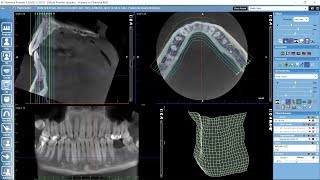 Working with panoramic view in Planmeca Romexis 3D module [upl. by Eatnahc]