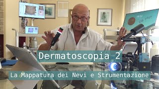 mappatura dei nevi strumentazione [upl. by Rainer478]