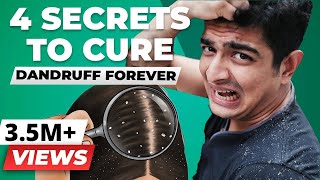 4 SECRET Tips To Remove Dandruff Forever  BeerBiceps Health [upl. by Ynnel]