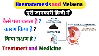 Haematemesis and Melaena किसे कहते कारण किया है and Treatment medicine किया है [upl. by Lytle241]