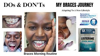 My Braces Morning RoutineAdapting To A New Lifestyle [upl. by Barbaraanne]