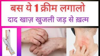 Luliconazole Cream  Luliconazole Cream Luliford  दाद खाज़ खुजली की दवा [upl. by Goran]