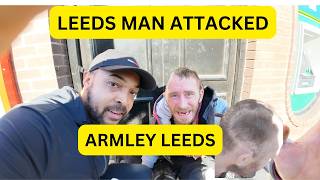 LEEDS MAN ATTACKED IN ARMLEY [upl. by Nutsud]