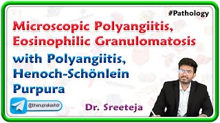 3 Microscopic Polyangiitis Eosinophilic Granulomatosis with Polyangiitis HenochSchönlein Purpura [upl. by Gnauq]