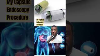 My Capsule Endoscopy Experience 2024 shorts [upl. by Carbrey]