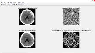 JOINT ENCRYPTION WATERMARKING SYSTEM USING AES AND RC4 FOR MEDICAL IMAGE [upl. by Gyimah396]