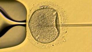 ICSI human sperm injection in vitro Fertility Specialists of Texasavi [upl. by Amikehs]