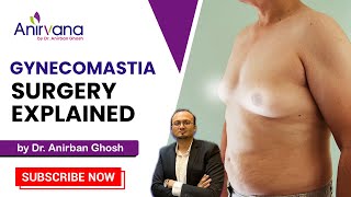 Gynecomastia Surgery Explained  Dr Anirban Ghosh  gynecomastiaplasticsurgery cosmaticsurgery [upl. by Bala]