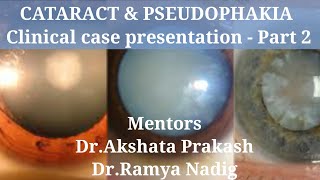 CATARACT amp PSEUDOPHAKIA Clinical case presentation  Part 2 [upl. by Hawkie]