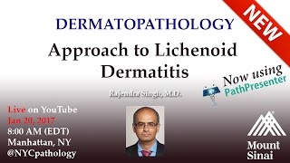 Dermatopathology Approach to Lichenoid Dermatitis  w Dr Singh [upl. by Negrom]