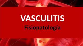 Vasculitis  Fisiopatología [upl. by Aima]