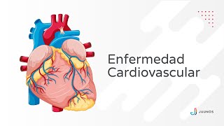 Enfermedad Cardiovascular o Enfermedad Cardiaca Principales enfermedades causas y síntomas [upl. by Esilec]