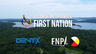 DentX Canada amp FNPI in Sagamok Anishnawbek First Nation [upl. by Eilasor84]