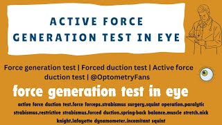 Force generation test  Forced duction test  Active force duction test  OptometryFans [upl. by Lepp]