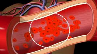 SMOKING effects on MOUTH and TEETH  consequences of TOBACCO cigarettes [upl. by Mcquade]