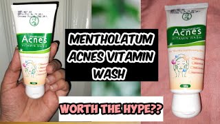 Mentholatum Acnes VITAMIN Face WashHonest ReviewIs it worth the hype [upl. by Okeim]